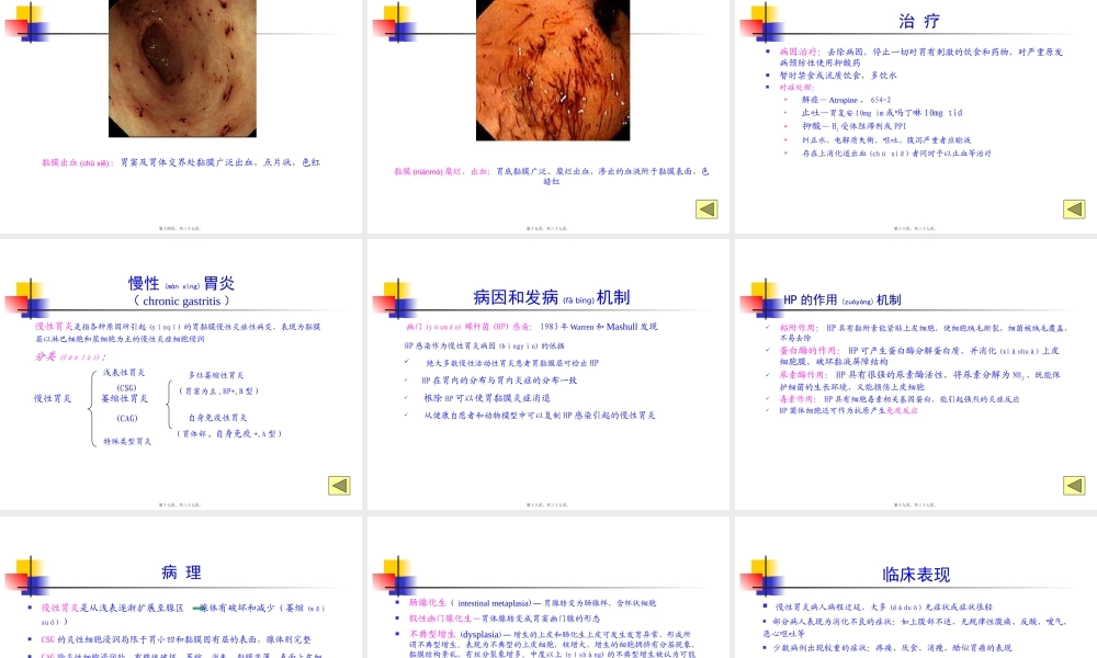 2022年医学专题—第四篇-第四章-胃炎.pptx