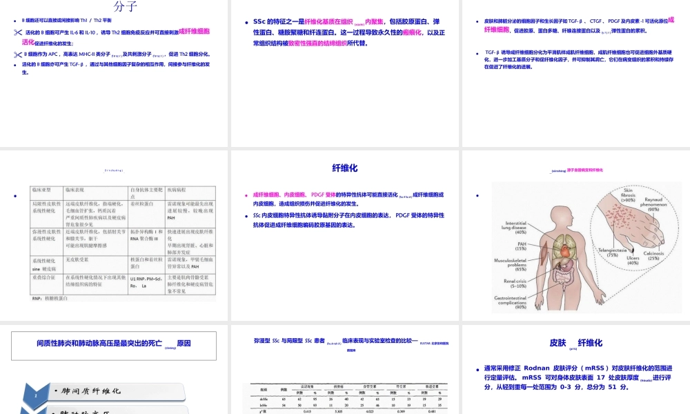 2022年医学专题—系统性硬化症诊治进展.ppt