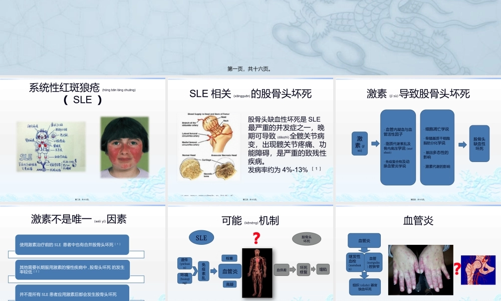 2022年医学专题—系统性红斑狼疮相关股骨头坏死.pptx