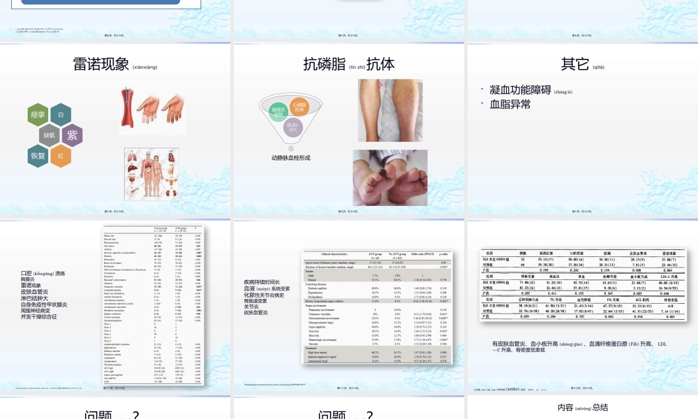 2022年医学专题—系统性红斑狼疮相关股骨头坏死.pptx