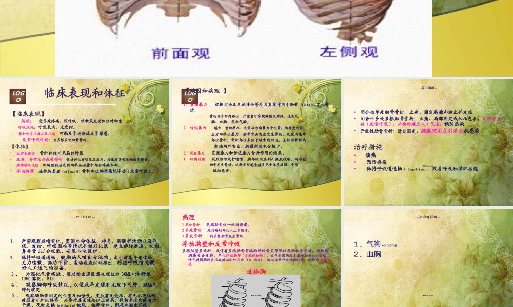 2022年医学专题—肋骨骨折查房---修改本知识.ppt
