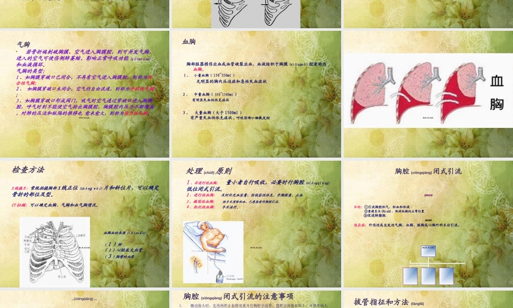 2022年医学专题—肋骨骨折查房---修改本知识.ppt