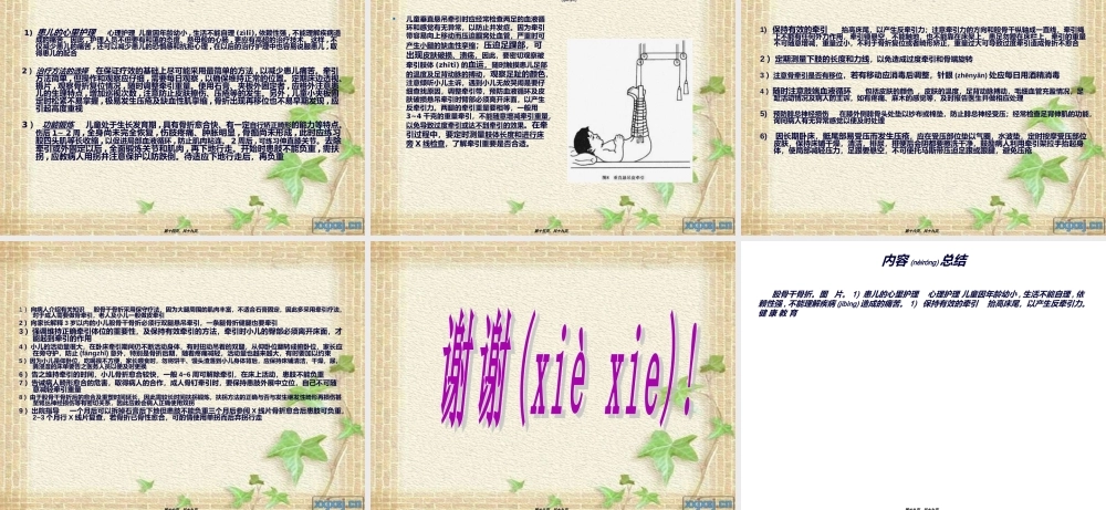 2022年医学专题—股骨干骨折(2012.10)...ppt