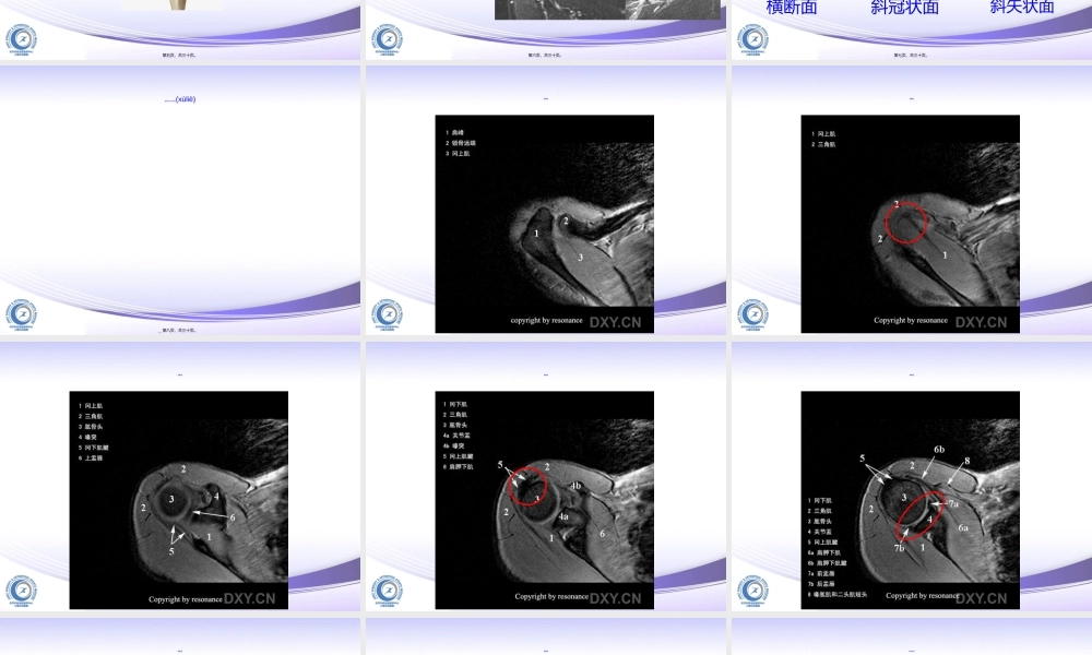 2022年医学专题—肩关节MRI读片.ppt