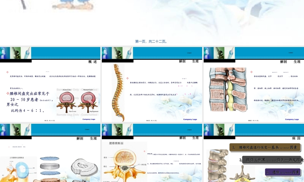 2022年医学专题—腰-椎-间-盘-突-出-症(欧).ppt