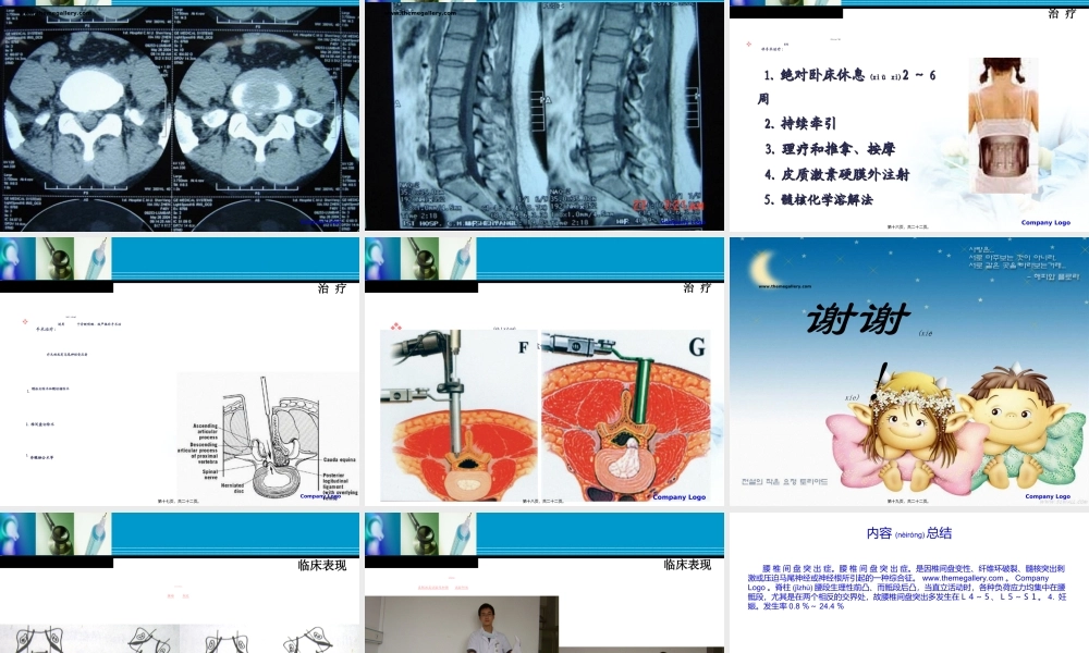 2022年医学专题—腰-椎-间-盘-突-出-症(欧).ppt