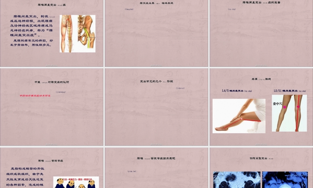 2022年医学专题—腰腿痛知识讲座(科室).ppt