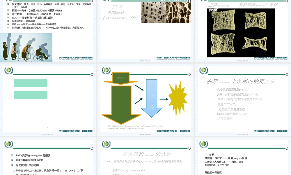 2022年医学专题—腰痛与骨质疏松浅识.ppt