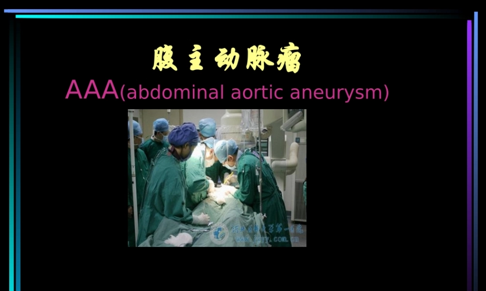 2022年医学专题—腹主动脉瘤.ppt2.ppt
