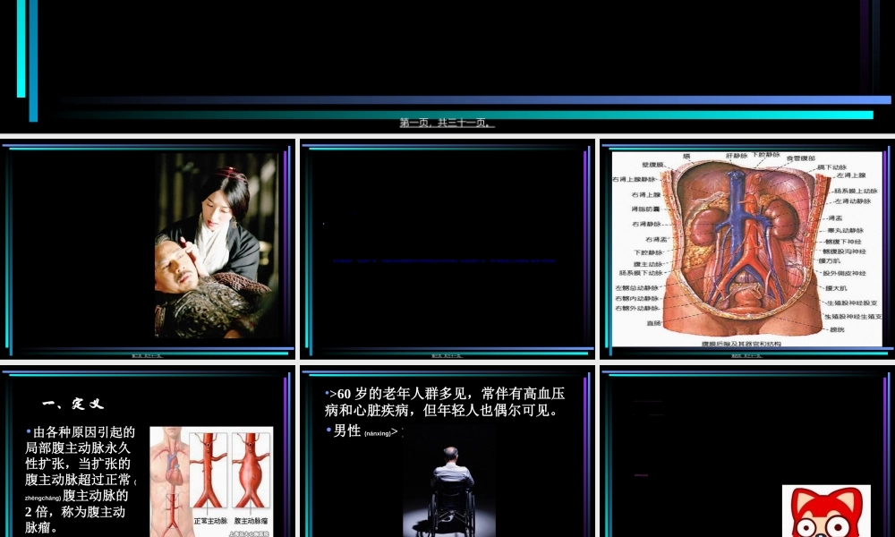 2022年医学专题—腹主动脉瘤.ppt2.ppt