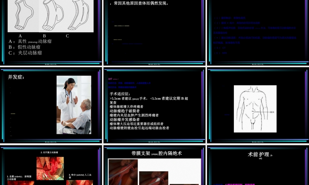 2022年医学专题—腹主动脉瘤.ppt2.ppt