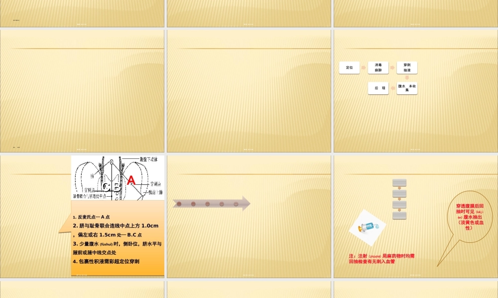 2022年医学专题—腹腔穿刺术.ppt