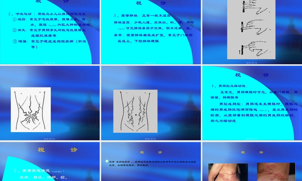 2022年医学专题—腹部.ppt