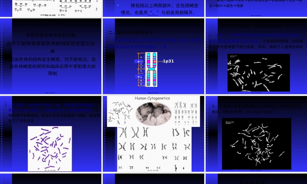 人染色体与染色体病.pptx