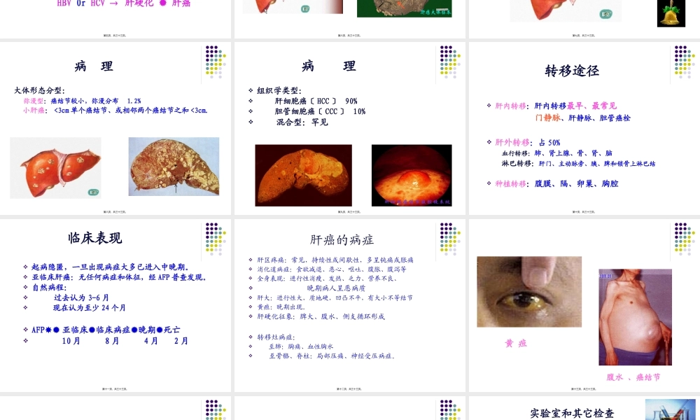 任务24原发性肝癌.pptx