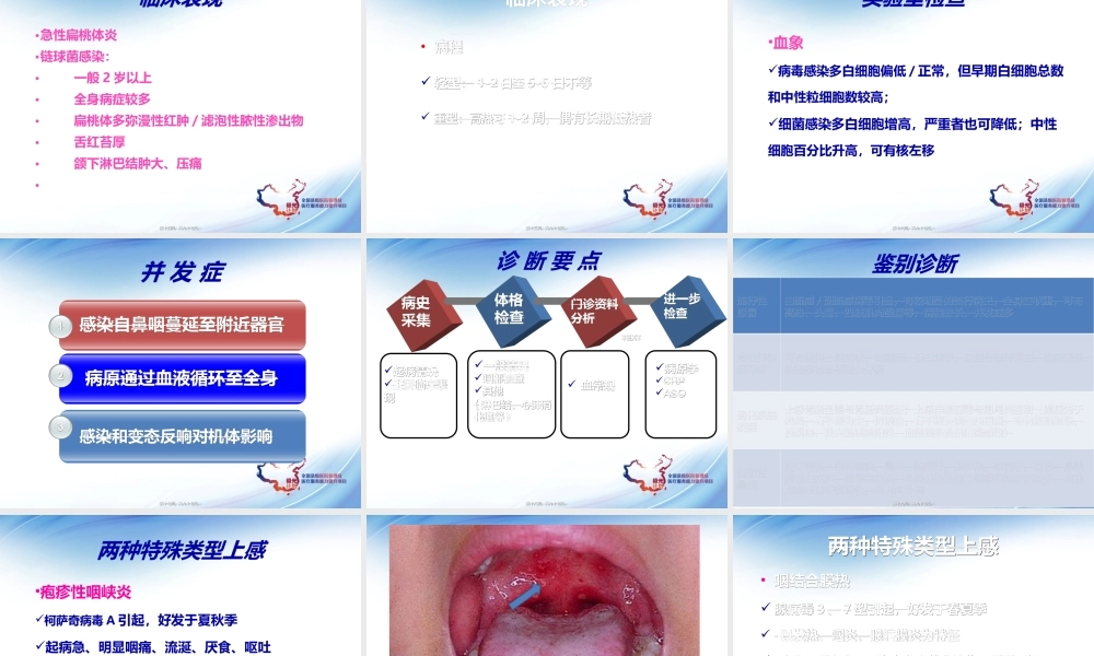 儿童上呼吸道感染及合理用药.ppt