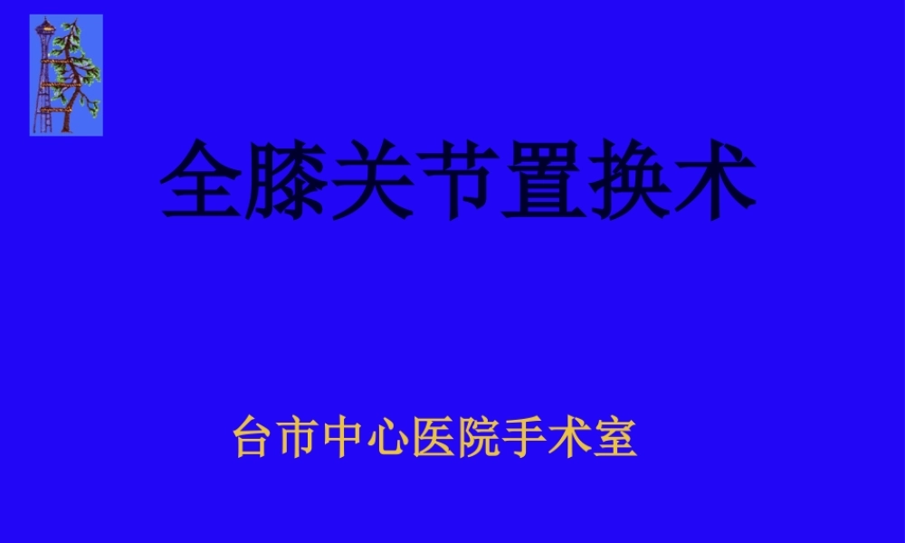 全膝关节置换.pptx