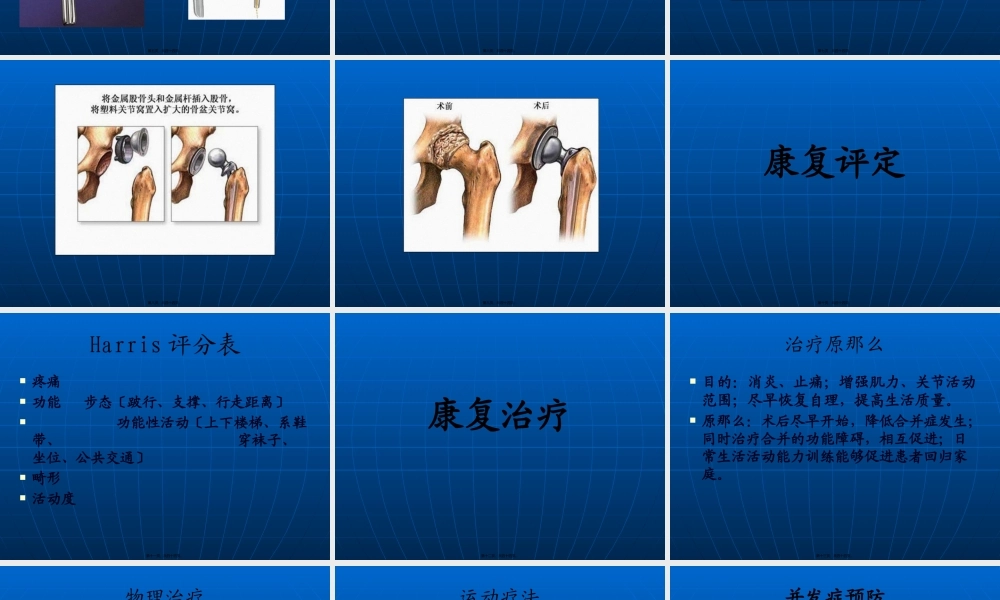 全髋关节置换手术后康复.pptx