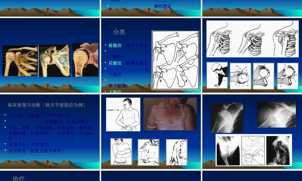 关节脱位损伤.pptx