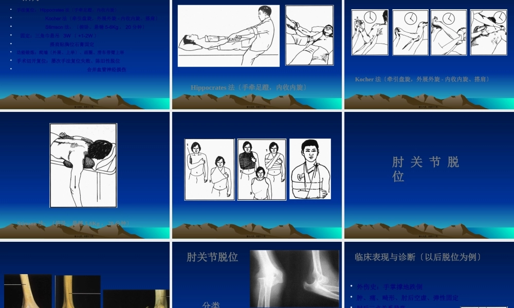 关节脱位损伤.pptx