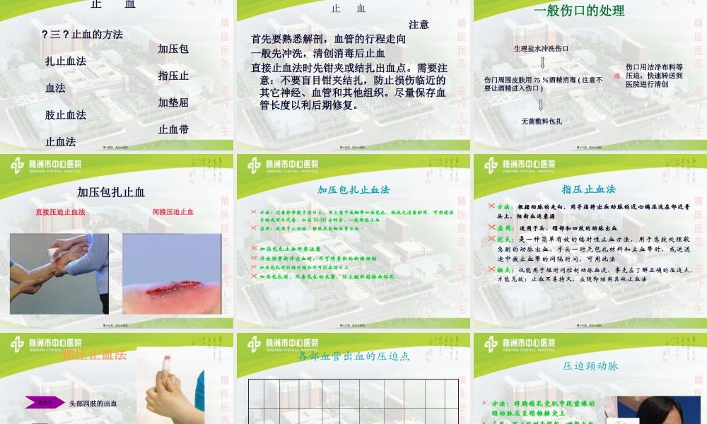 创伤的包扎止血固定.pptx