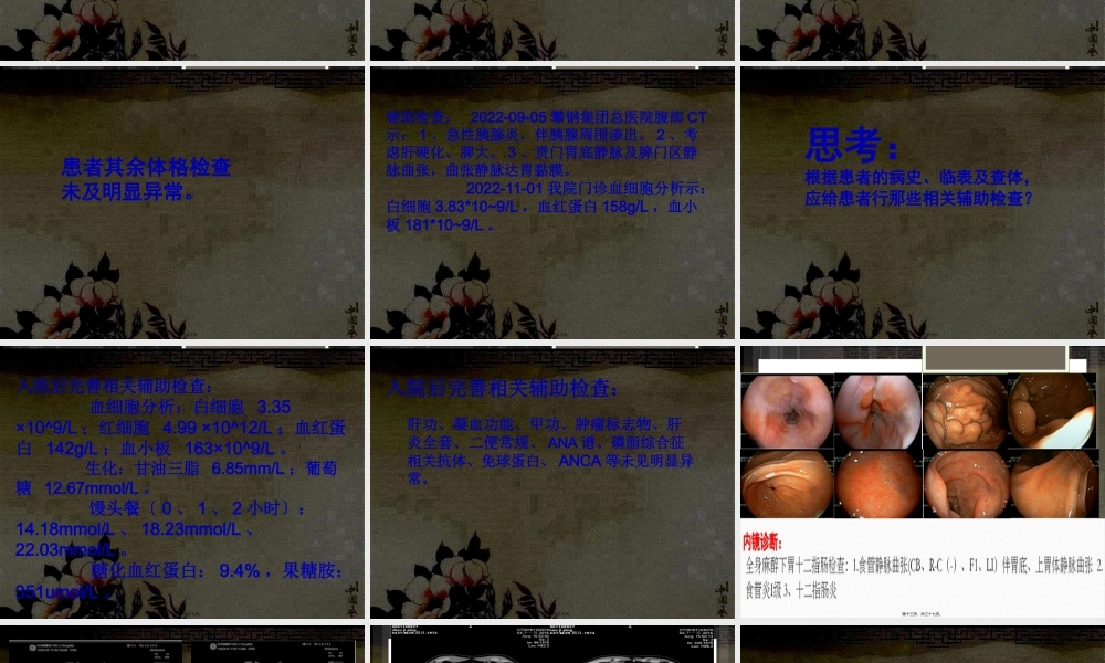 区域性门脉高压概要.pptx