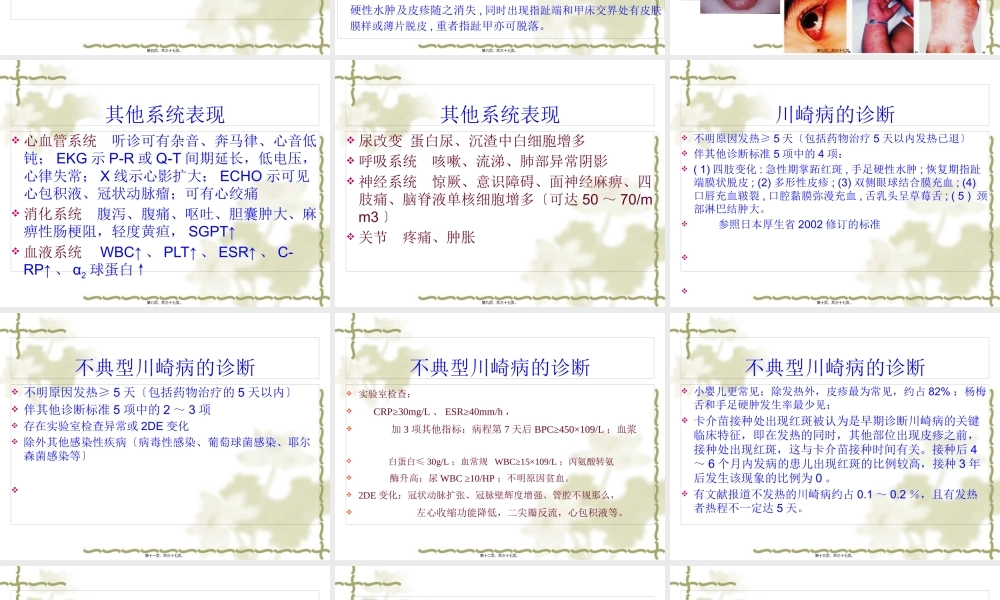 发热为最早出现的症状.pptx