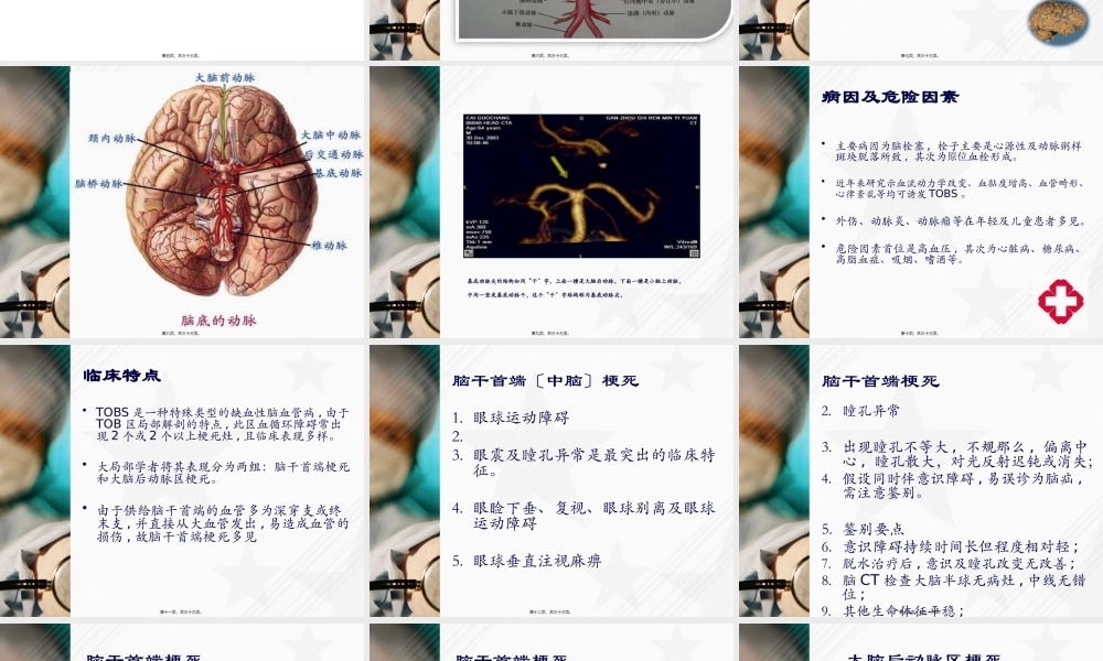 基底动脉尖综合征.pptx