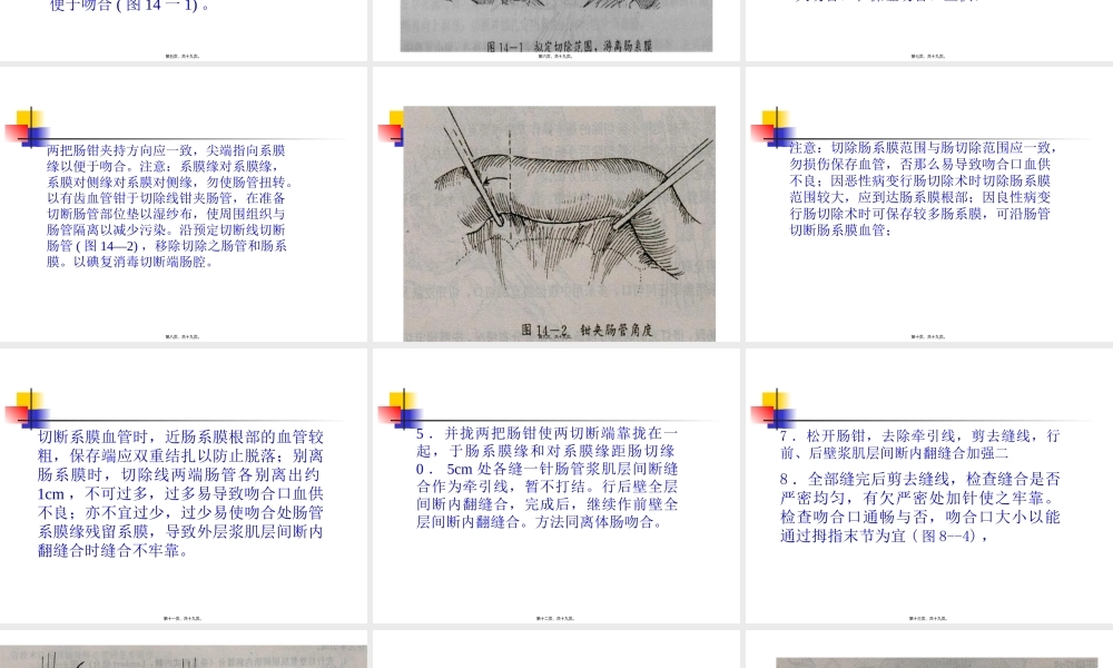 外科手术学-肠切除端-端肠吻合术--.pptx