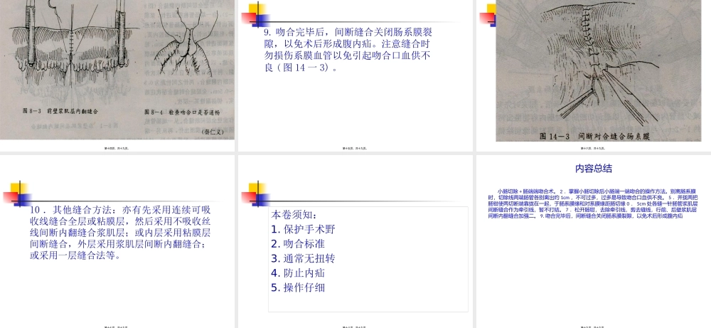 外科手术学-肠切除端-端肠吻合术--.pptx