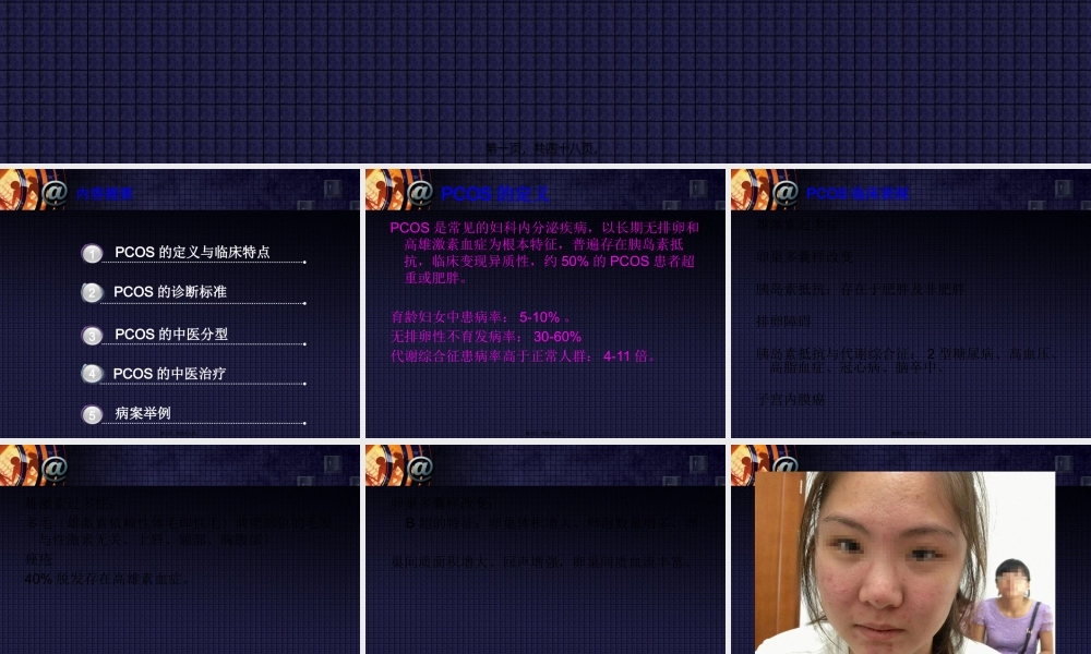 多囊卵巢综合症的辨治体会分解.pptx