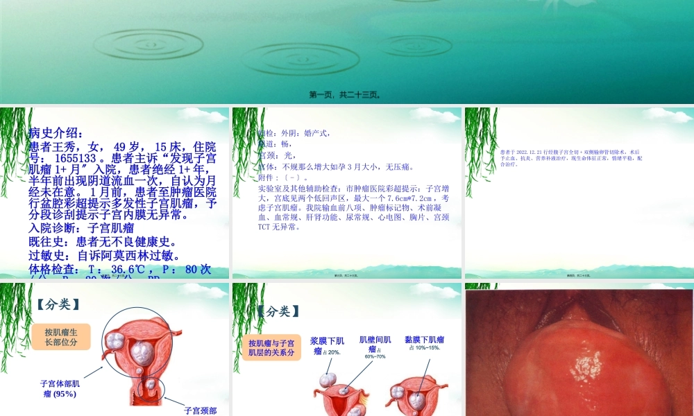 子宫肌瘤的教学查房.pptx