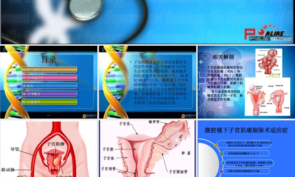 子宫肌瘤剔除术详解.ppt