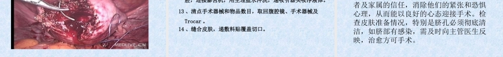 子宫肌瘤剔除术详解.ppt