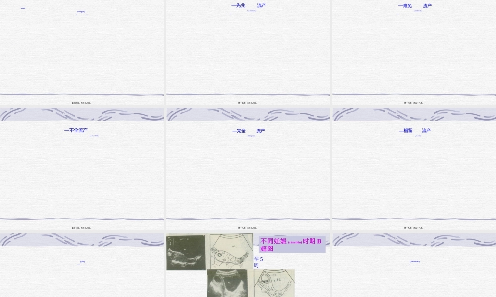2022年医学专题—中西医结合-流产.ppt