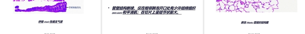 2022年医学专题—肺的结构.ppt