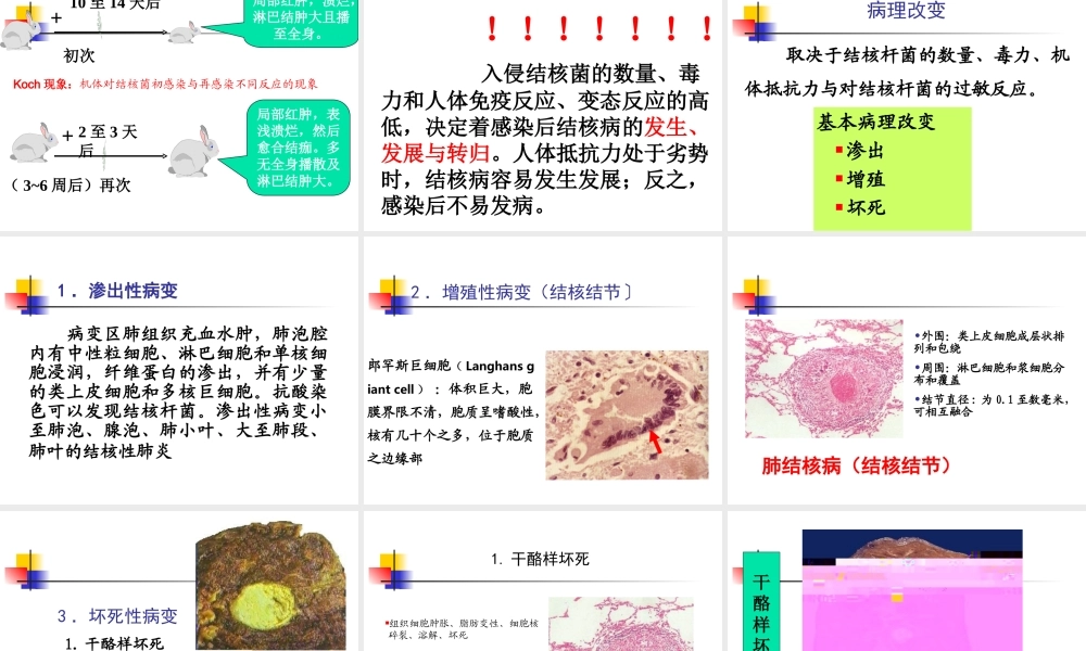 7肺结核-1.ppt