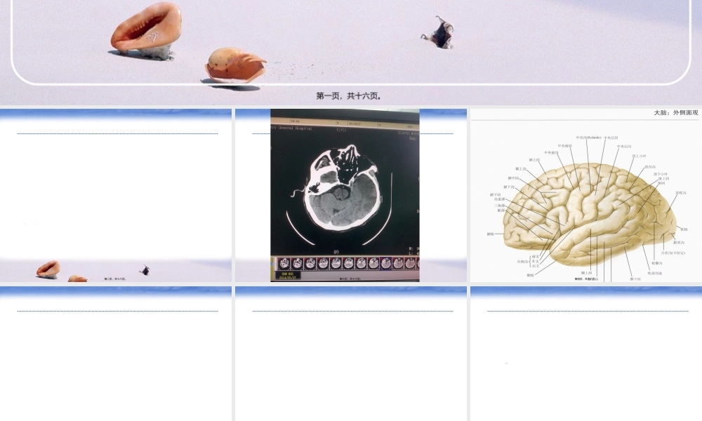 2022年医学专题—NICU脑梗塞.ppt