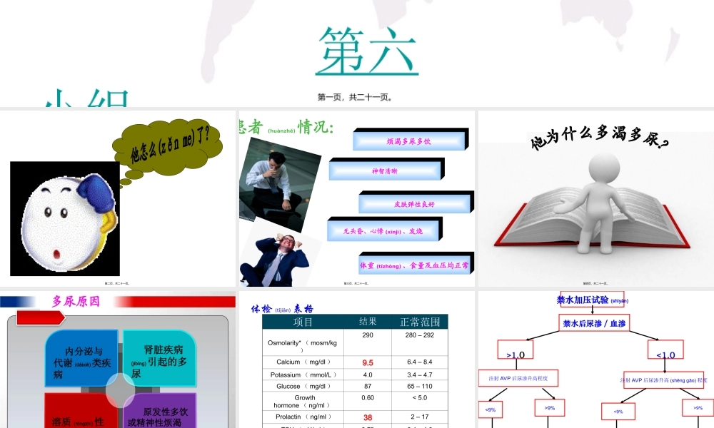 2022年医学专题—中枢性尿崩症Centraldiabetesinspidus.ppt