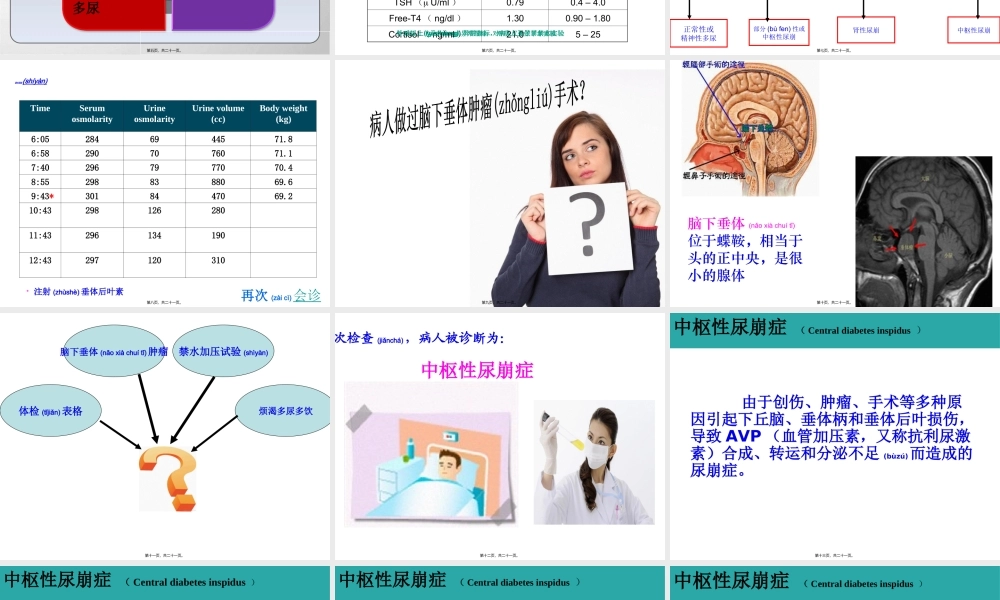 2022年医学专题—中枢性尿崩症Centraldiabetesinspidus.ppt