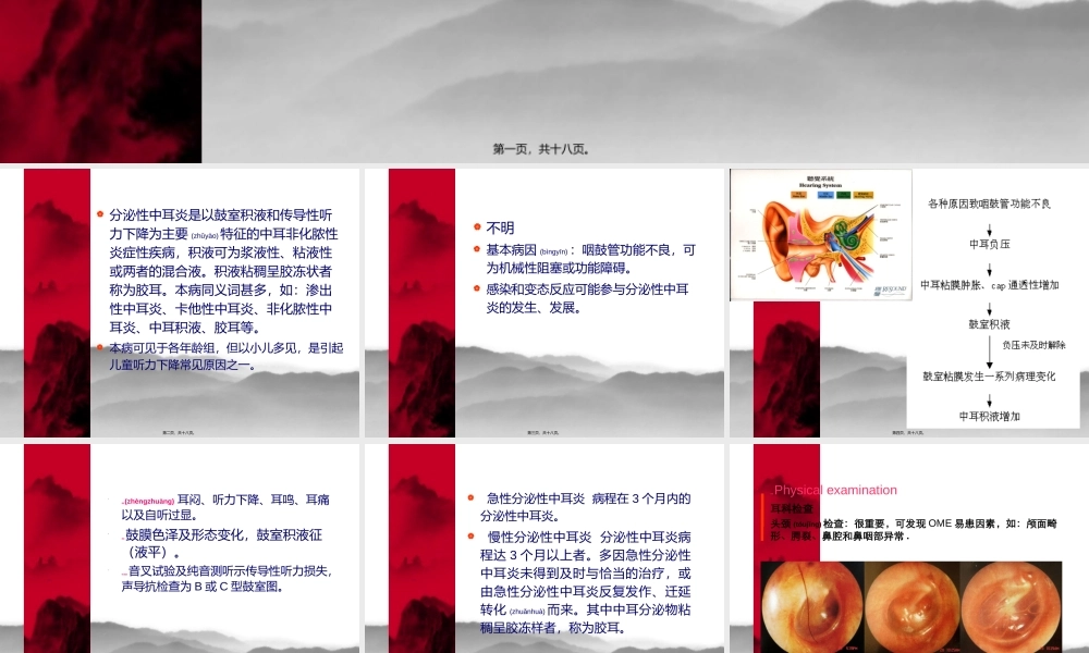 2022年医学专题—分泌性中耳炎(新)实习.ppt