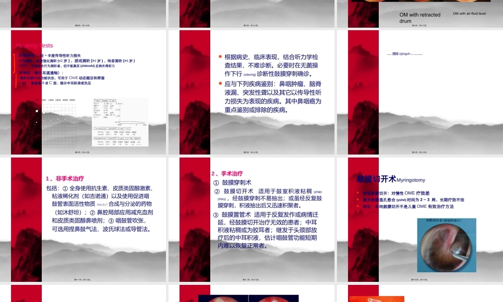 2022年医学专题—分泌性中耳炎(新)实习.ppt