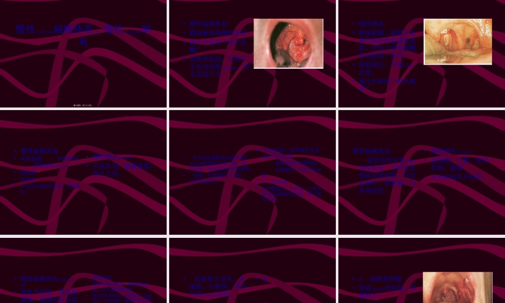 2022年医学专题—急性咽炎、急性扁桃体炎2.ppt