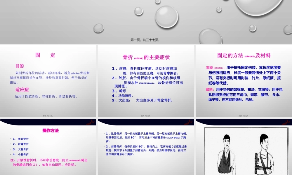 2022年医学专题—四肢骨折的固定搬运.pptx