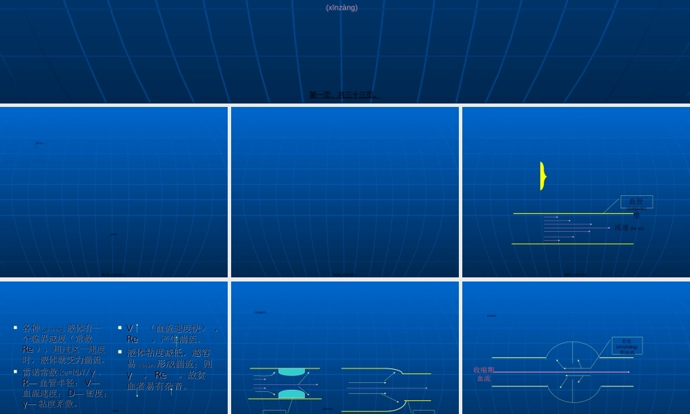 2022年医学专题—心脏体格检查——听诊3心脏杂音幻灯片.ppt