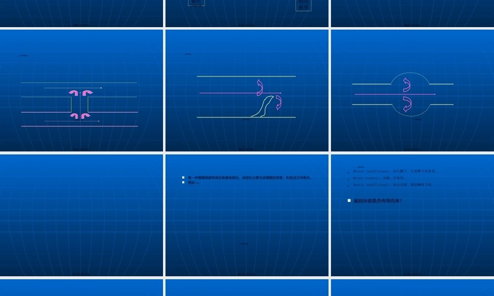 2022年医学专题—心脏体格检查——听诊3心脏杂音幻灯片.ppt