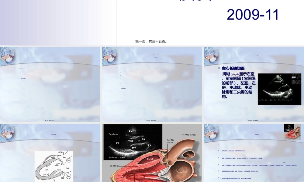 2022年医学专题—心脏超声检查.ppt