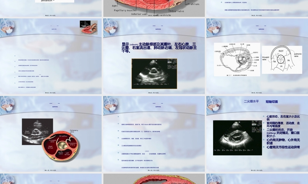2022年医学专题—心脏超声检查.ppt