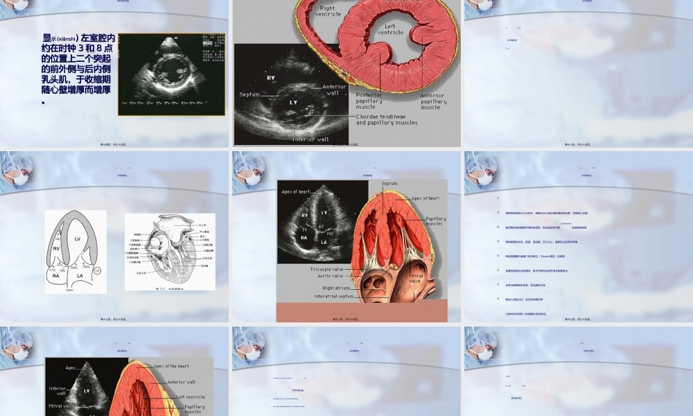 2022年医学专题—心脏超声检查.ppt