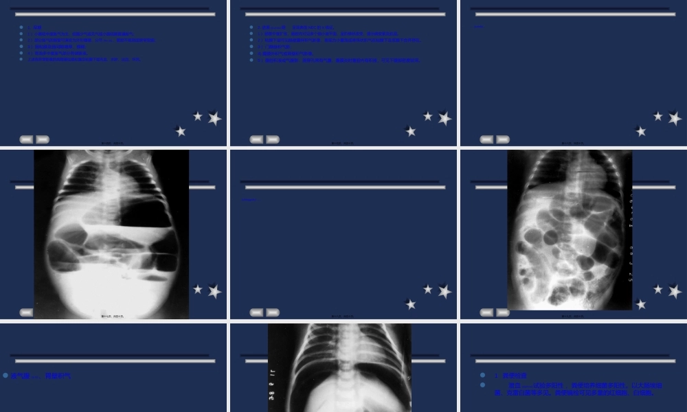 2022年医学专题—新生儿坏死性小肠结肠炎0.ppt